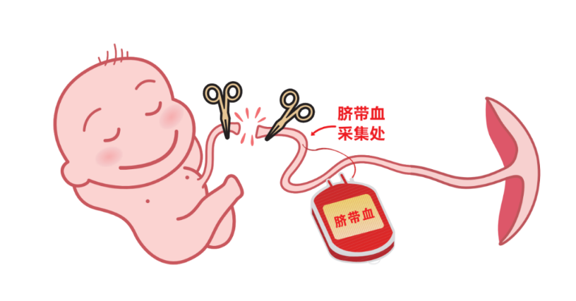 刷新纪录！浙江省脐血库脐带血治疗106Kg大体重患者！